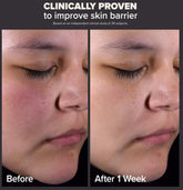 مجموعة باولا تشويس جولد ستاندرد 2% BHA جامبو وميني لبشرة صافية